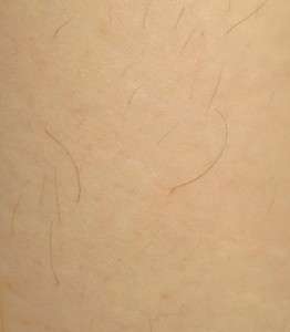 long hairs on the face