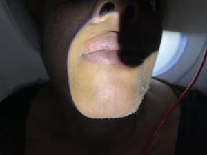 image of white hair on black skin
