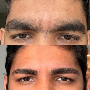 Image of male eyebrows that are dark and thick
